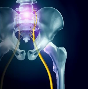 Human pelvis with highlighted sciatic nerve.